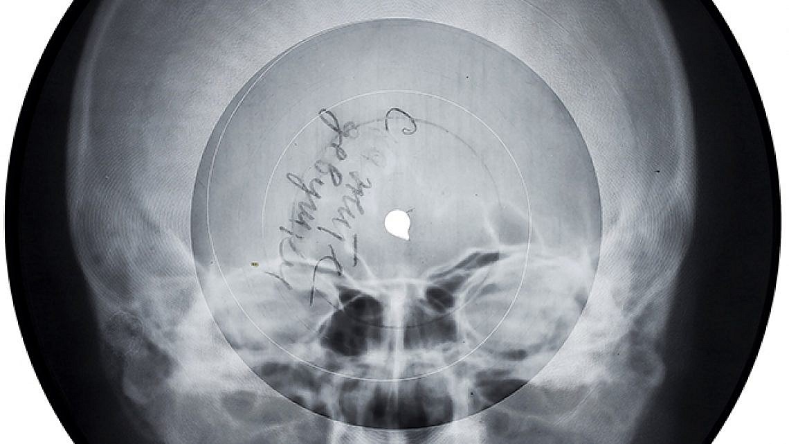 תקליט רנטגן, מתוך תערוכת "מוזיקה אסורה" (צילום: איציק בירן)