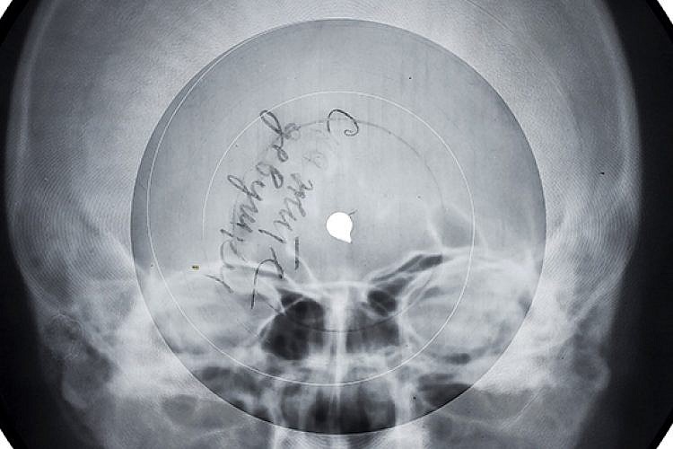 תקליט רנטגן, מתוך תערוכת "מוזיקה אסורה" (צילום: איציק בירן)