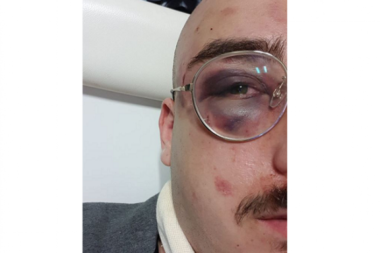 עידו מאיר, בתמונה שהעלה לעמוד הפייסבוק שלו לאחר התקיפה